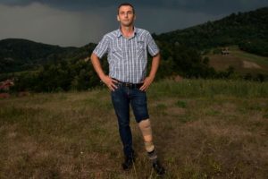 PROD-Malic-Bradaric-Bosnian-War-Princess-Diana-Amputee-Landmine